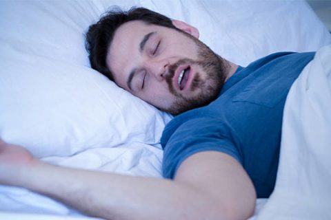 【标准与规范】成人阻塞性睡眠呼吸暂停高危人群筛查与管理专家共识